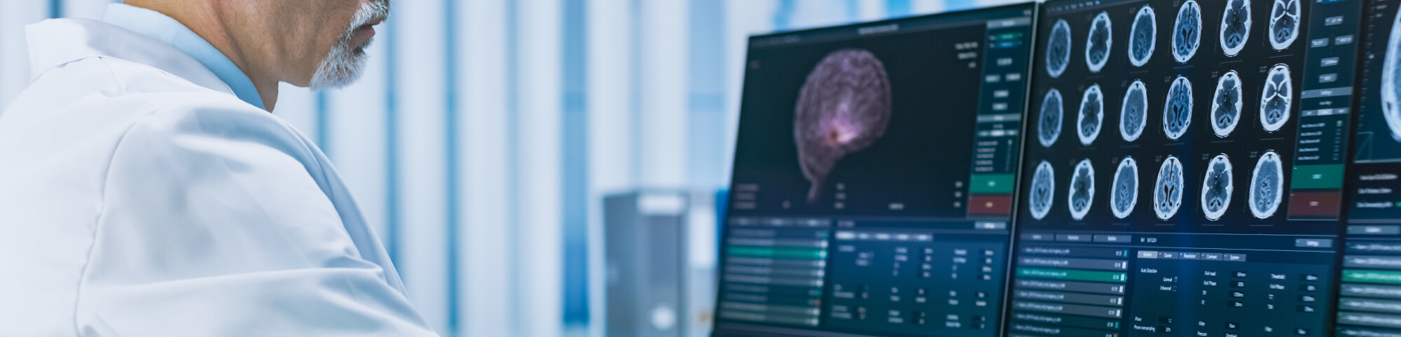 Arzt analysiert MRT-Bilder eines Gehirns